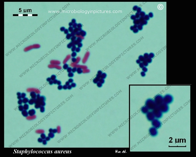 Gram-stain, Staphylococcus Aureus And Escherichia Coli. Gram Staining ...